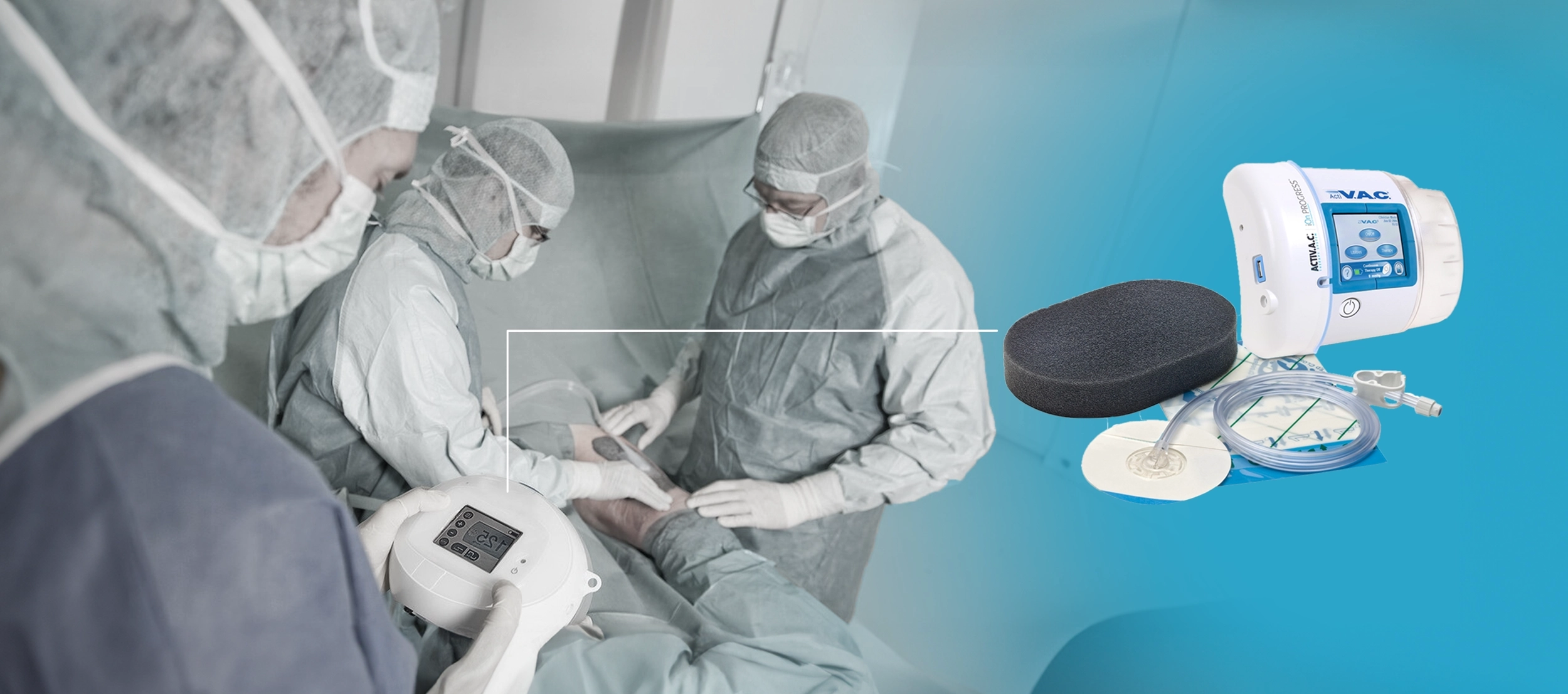 izmir vac, izmir vac tedavisi, izmir evde yara bakim, izmir poli̇kli̇ni̇k yara bakim, vac tedavisi izmir